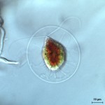 Haematococcus_pluvialis_big