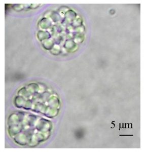 圖12. Aurantiochytrium limacinum（不知道中文叫什么，可以看到細胞里一個個油滴，by Abad &Turon, 2015）