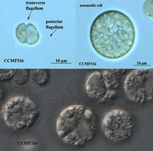 圖17.寇氏隱甲藻CCMP316株，左上圖細胞帶著鞭毛，右上圖是積累了油脂之后的形態(tài)，這個藻種是目前DHA藻油的主力生產(chǎn)藻種之一（要買這藻種找老倪）。